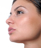 Facial Implants |  Newtown