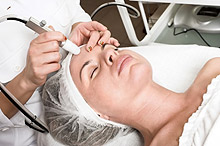 Laser Skin Resurfacing |  Newtown